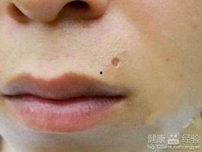 痣瓜怎么吃最好,解锁健康美味新体验